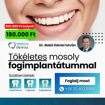 Fogászati implantátum akció